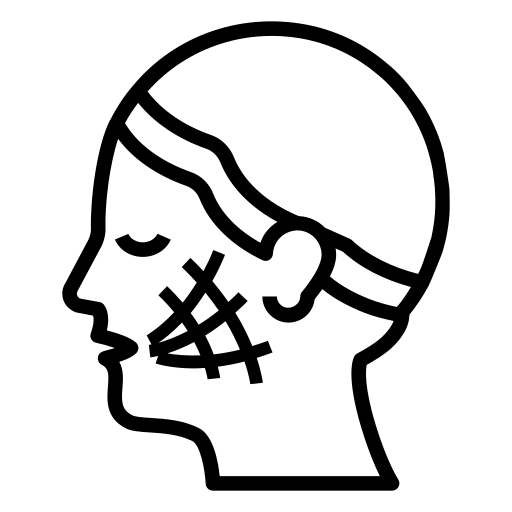 Aplicação de Fios de PDO
