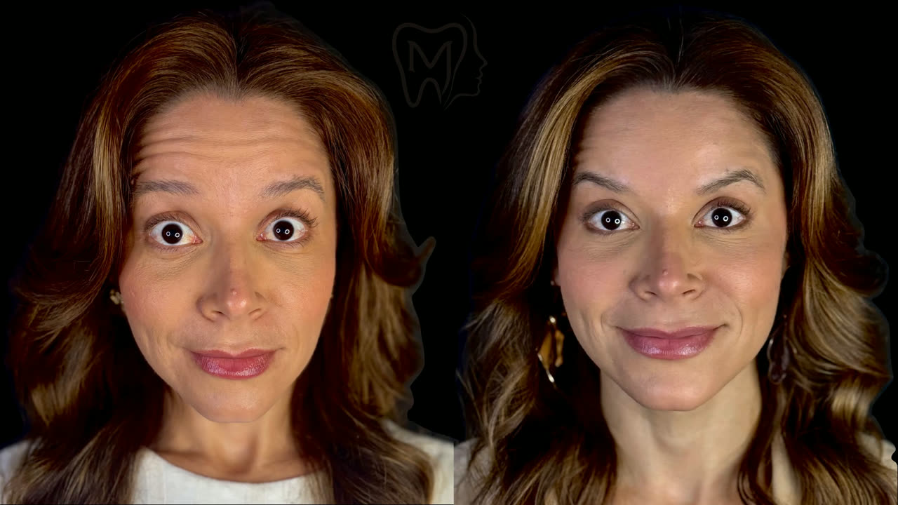 Resultado de tratamento com a Dra. Lethícia S. de Oliveira, antes e depois